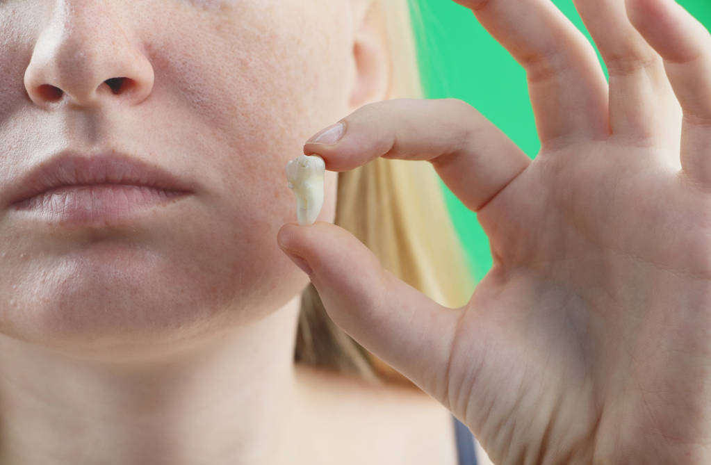 Can Wisdom Teeth Come Back After Being Removed?