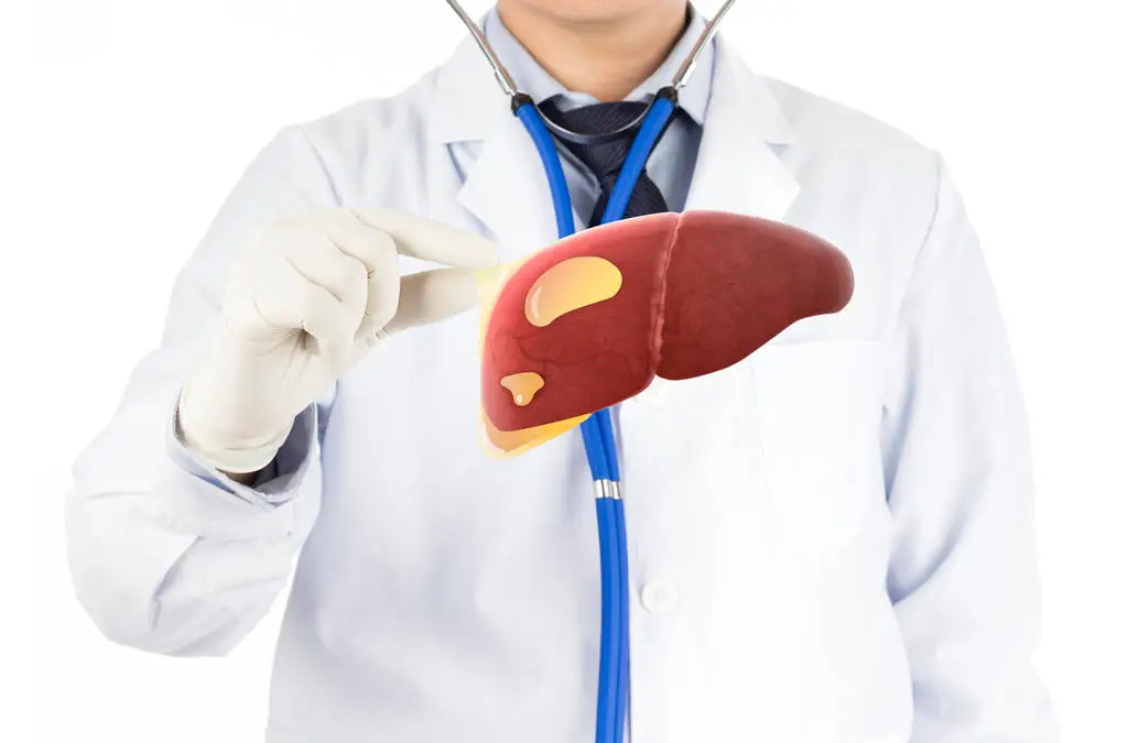Understanding the Fibrosis Score for Nonalcoholic Fatty Liver Disease