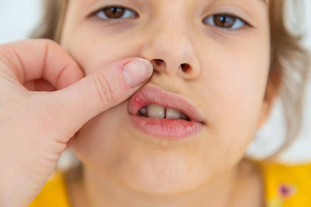 What Causes a Bump on Your Gums and How to Treat It