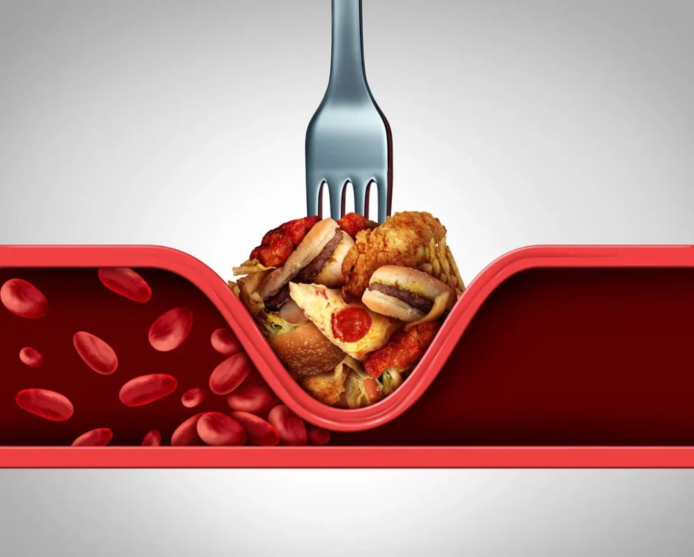 A Normal Cholesterol Number Does Not Tell You Everything
